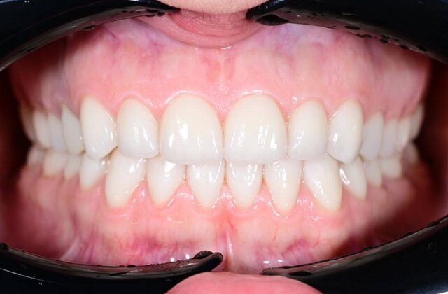 До